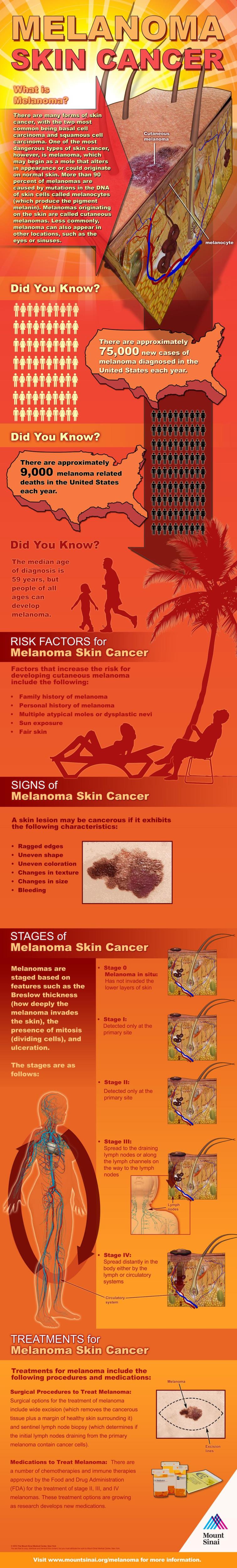 Melanoma Infographic - Merck Manuals Professional Edition