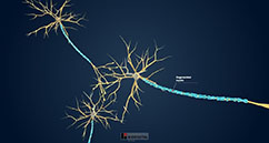 Sclerose En Plaques Sep Troubles Du Cerveau De La Moelle Epiniere Et Des Nerfs Manuels Msd Pour Le Grand Public